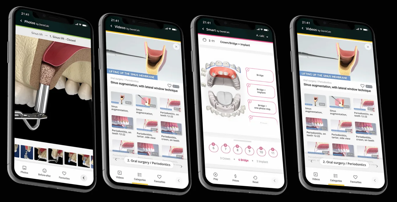 DentiCalc mobile app developed by Ackrolix